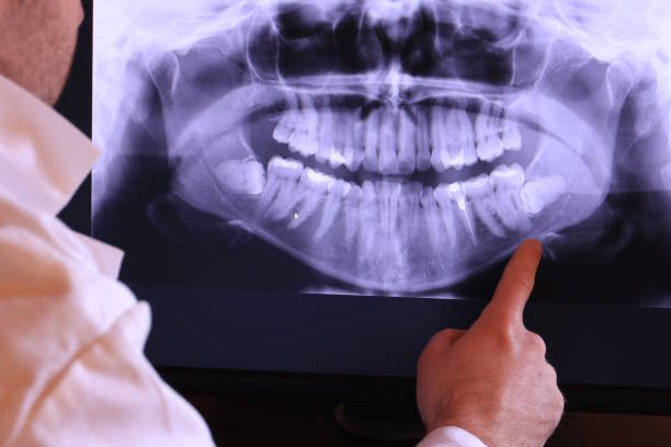 Best Emergency Treatment for Toothache in Maria Stein, OH